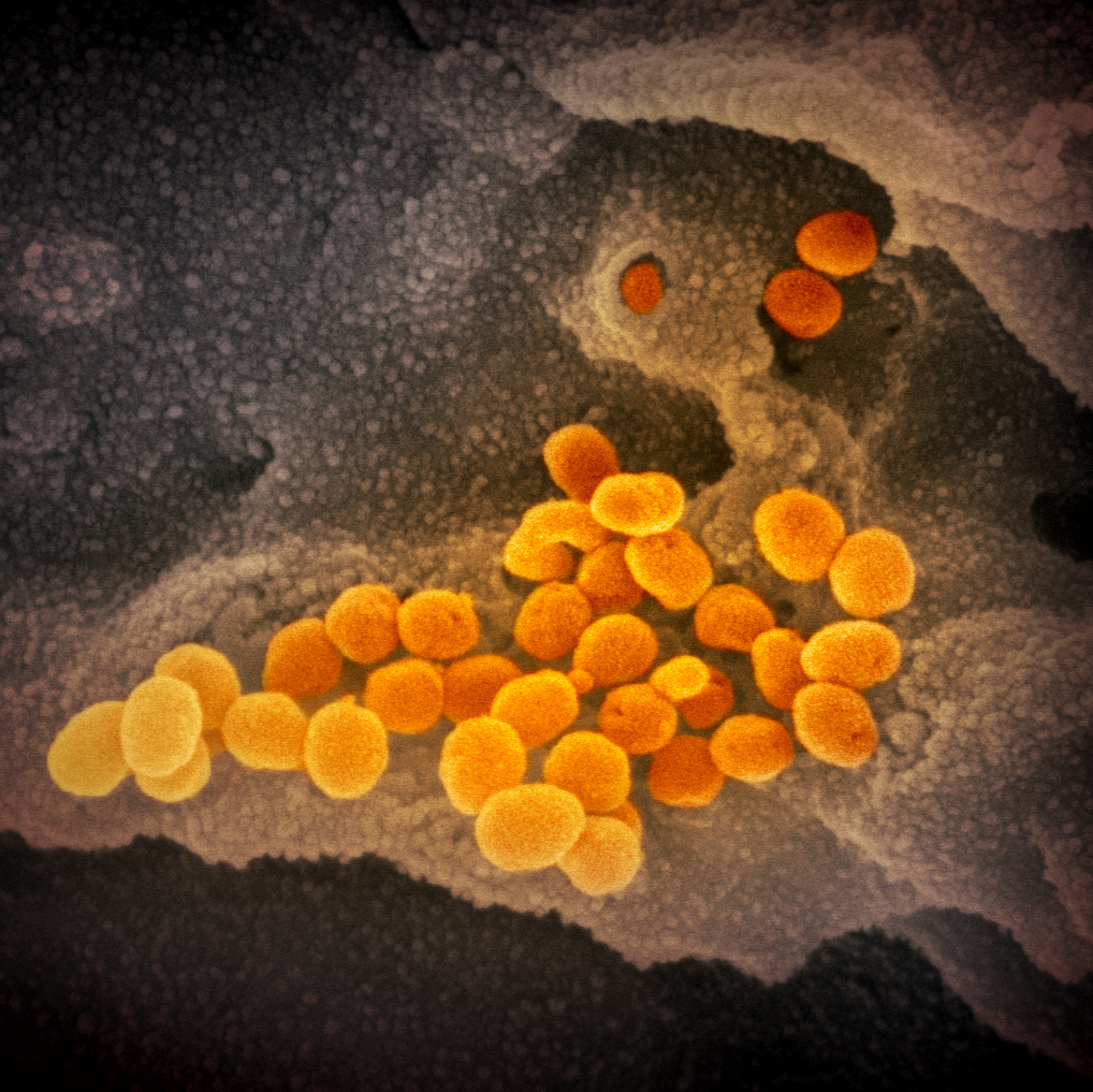 novel-coronavirus-sars-cov-2_49530315703_o.jpg novel-coronavirus-sars-cov-2_49530315703_o.jpg