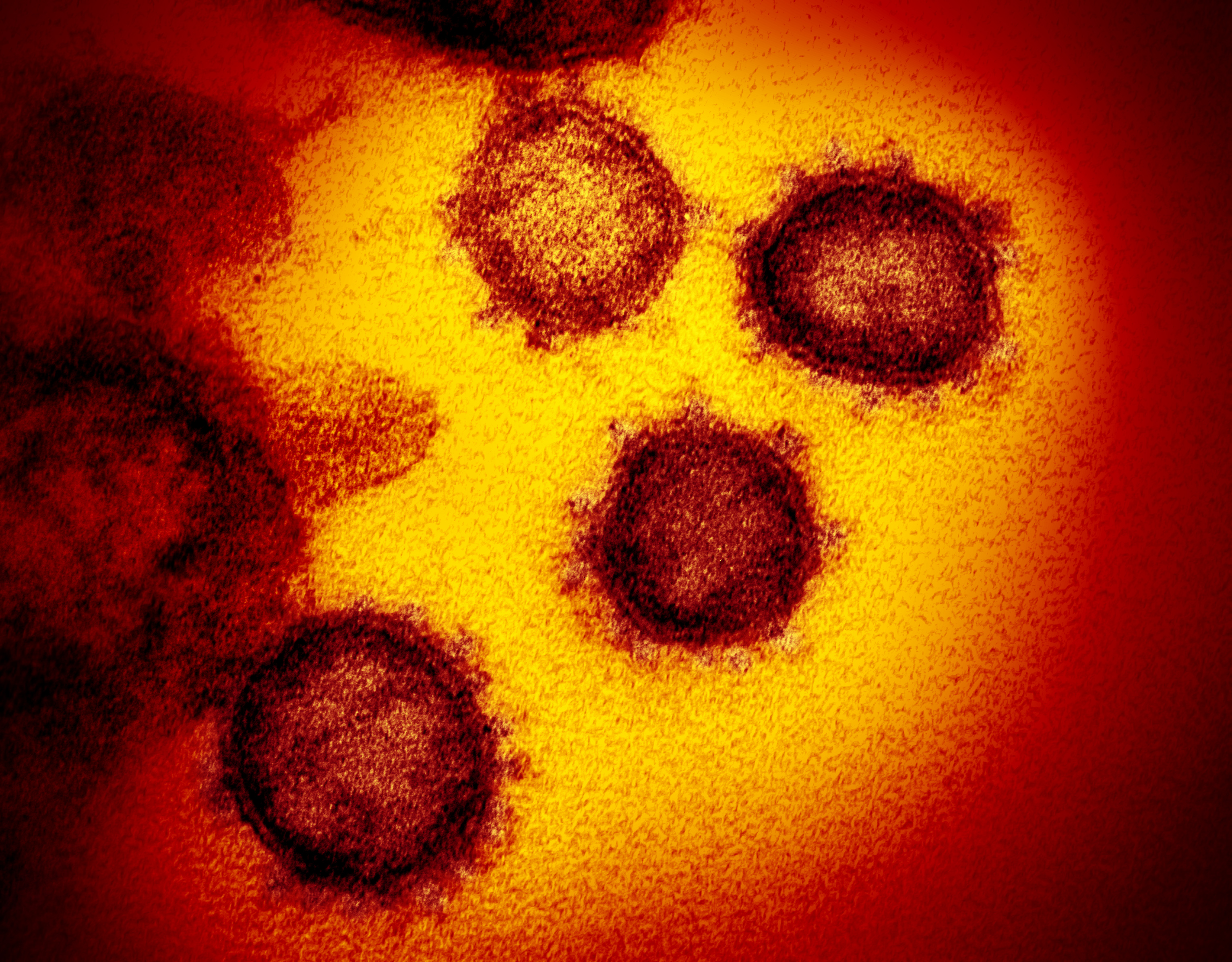 novel-coronavirus-sars-cov-2_49530315718_o.jpg novel-coronavirus-sars-cov-2_49530315718_o.jpg