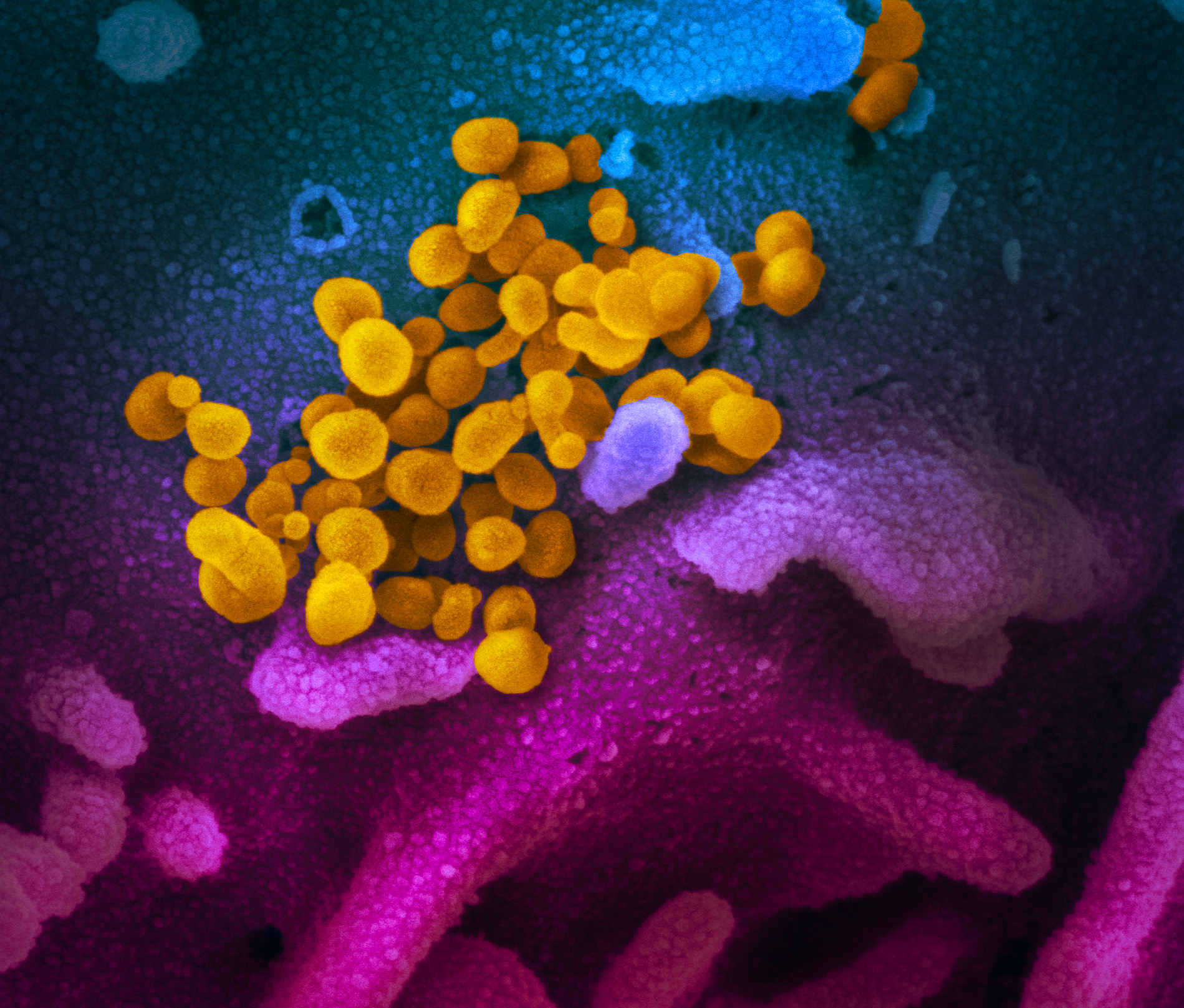 novel-coronavirus-sars-cov-2_49531042877_o.jpg novel-coronavirus-sars-cov-2_49531042877_o.jpg
