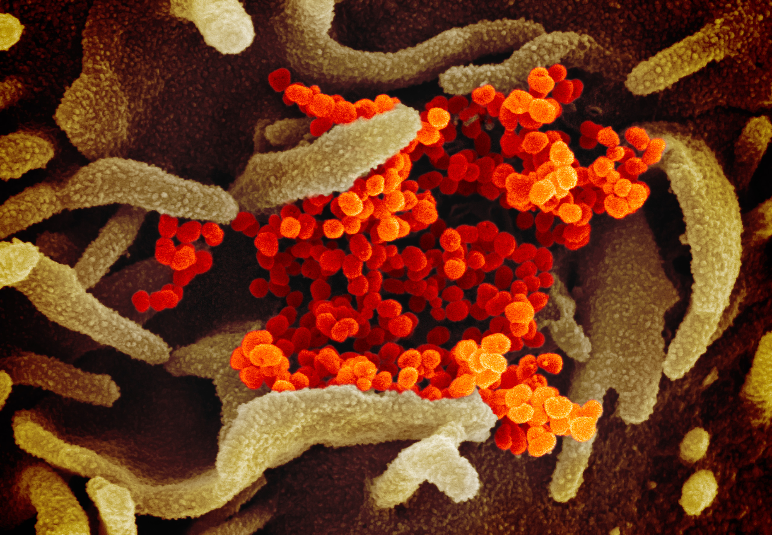 novel-coronavirus-sars-cov-2_49531042907_o.jpg novel-coronavirus-sars-cov-2_49531042907_o.jpg