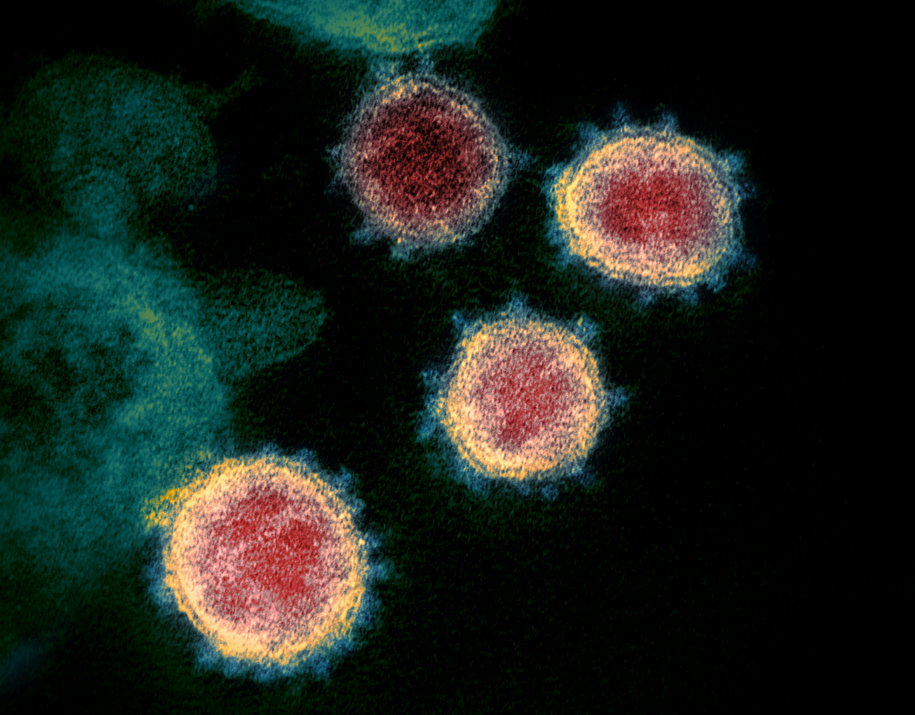 novel-coronavirus-sars-cov-2_49534865371_o.jpg novel-coronavirus-sars-cov-2_49534865371_o.jpg