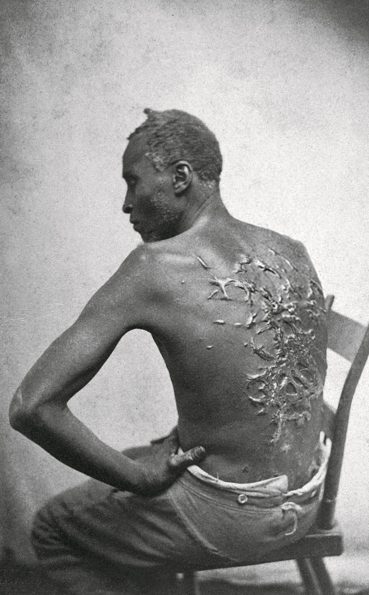 scourged_back_by_mcpherson_oliver_1863_retouched.jpg scourged_back_by_mcpherson_oliver_1863_retouched.jpg