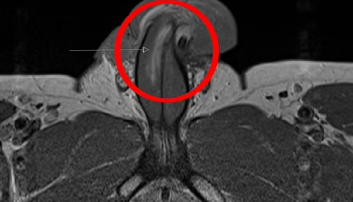 penis.png penis.png