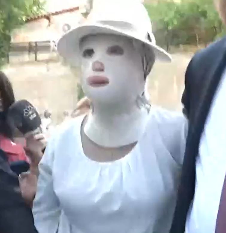 ioanna-2.jpg ιωαννα επίθεση με βιτριόλι πώς είναι